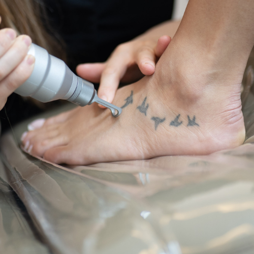 detatouage-laser-paris-16-accueil