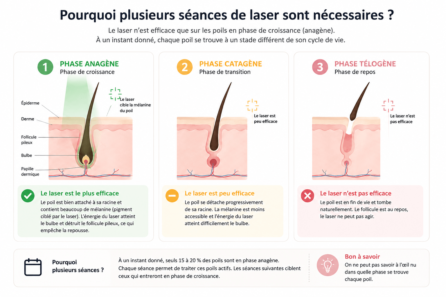 Schéma des trois phases du cycle du poil expliquant pourquoi plusieurs séances d'épilation laser sont nécessaires